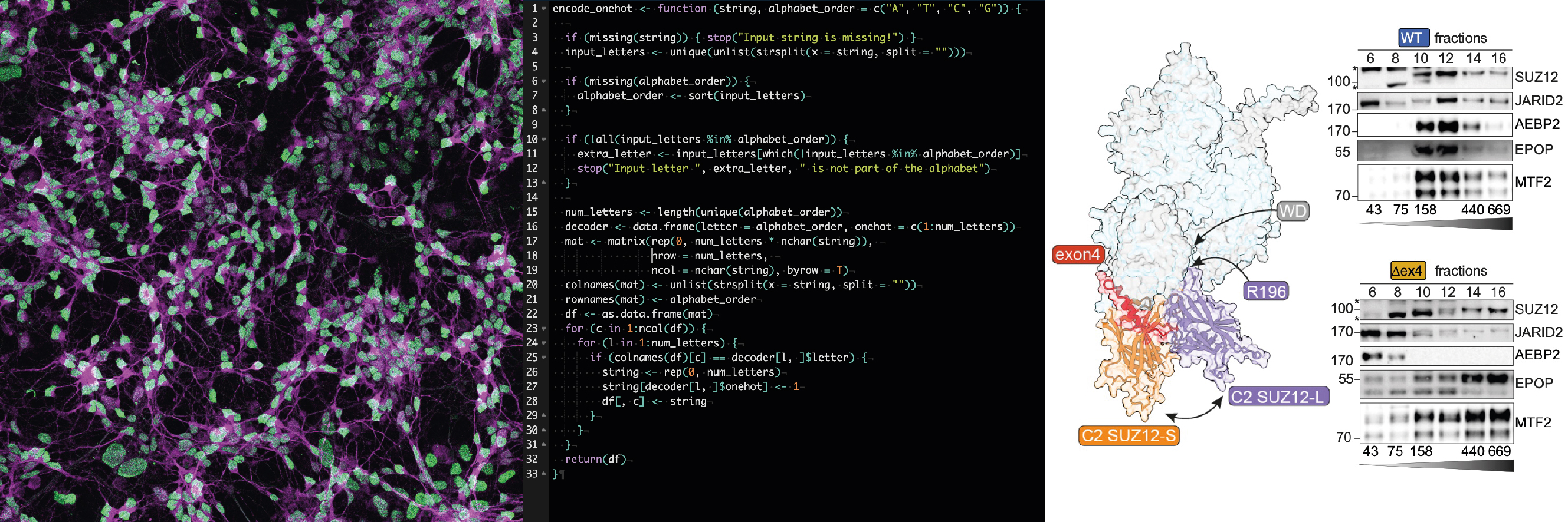 MAP2 and H3K27me3 glutamatergic neurons immunofluorescence